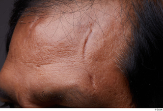 HD Face Skin Enoch Gorat eyebrow face forehead hair scar…